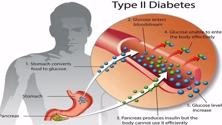 o que é diabetes tipo 2